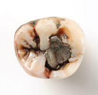 Complex fillings