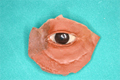maxillo-facial-prosthesis