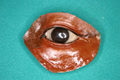 maxillo-facial-prosthesis